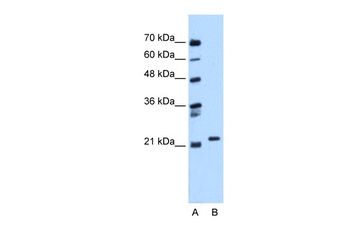 RAB11B Antibody
