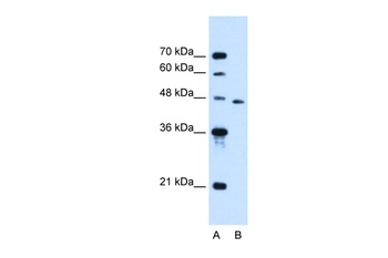 SLC16A12 Antibody