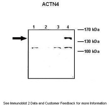 ACTN4 Antibody