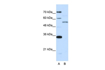 ZNF707 Antibody