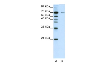 ZNF398 Antibody