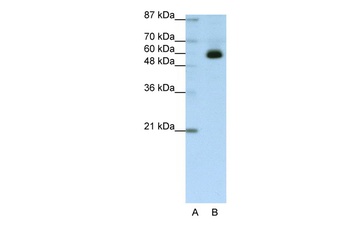 ZKSCAN4 Antibody