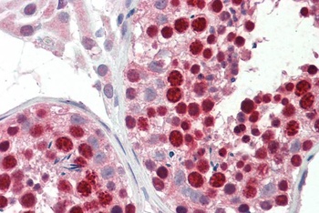 ABCA2 Antibody