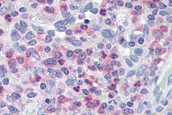UNC13D Antibody