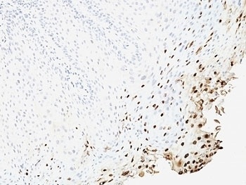 L1 Antibody [SPM257]