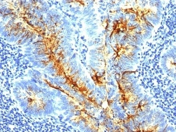 TAG-72 Antibody [SPM536]