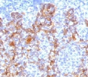 K77 Antibody