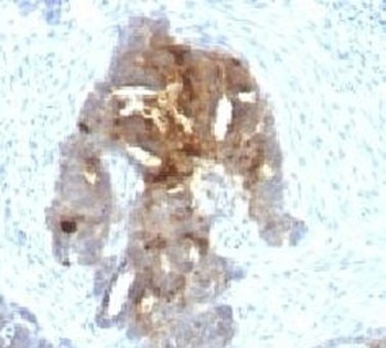 tag-72 Antibody