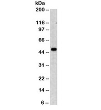 KRT8 Antibody