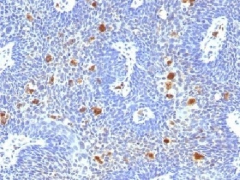 HPV-16 Antibody [HPV16/1296]