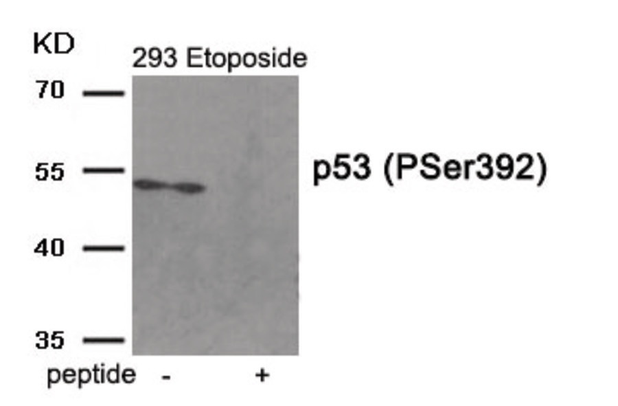 TP53 Antibody