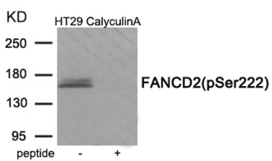 FANCD2 Antibody