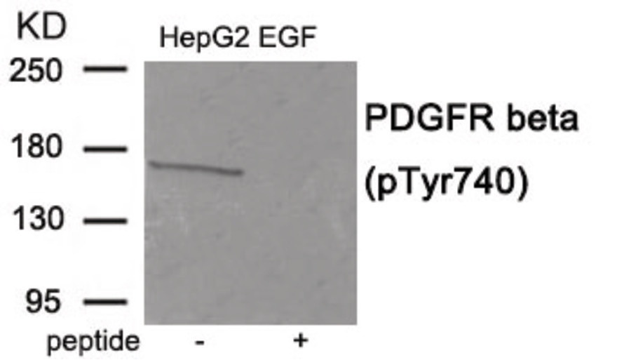 PDGFRB Antibody