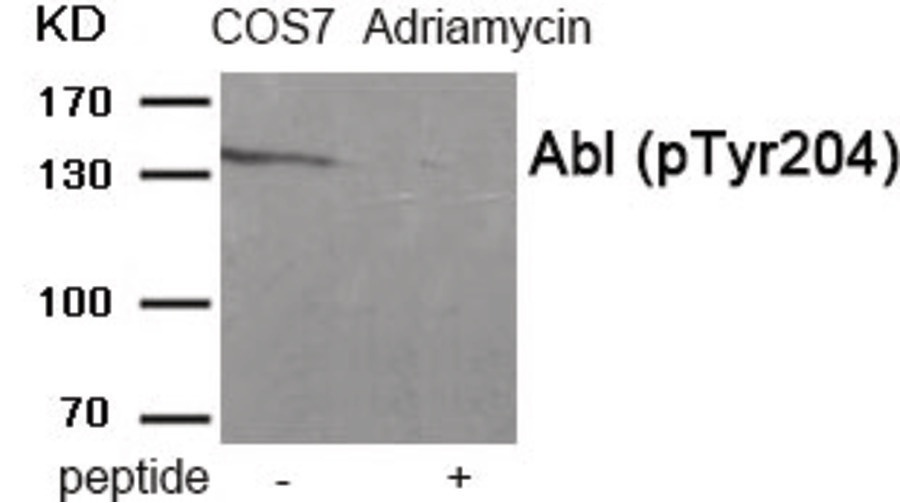 ABL1 Antibody