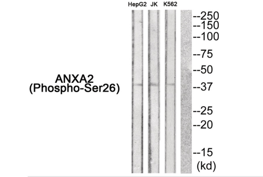 ANXA2 Antibody