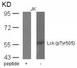 LCK Antibody