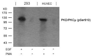 PRKD1 Antibody