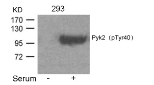 PTK2B Antibody