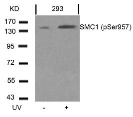 SMC1A Antibody