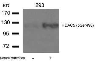 HDAC5 Antibody