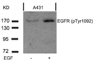 EGFR Antibody