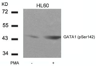 GATA1 Antibody
