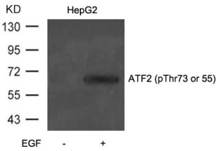 ATF2 Antibody