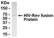rev, p19, Human immunodeficiency virus 1, HIV Antibody