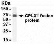 CPLX1 Antibody