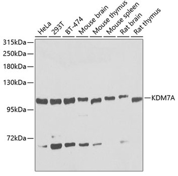 KDM7A Antibody