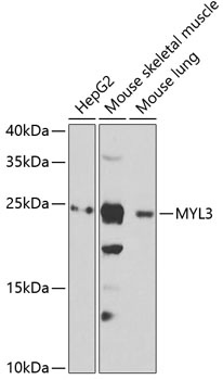 MYL3 Antibody
