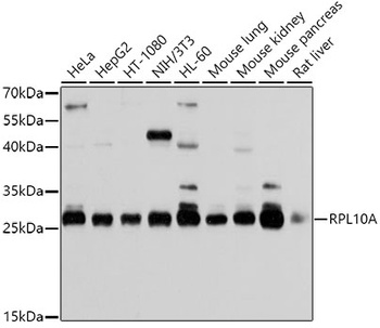 RPL10A Antibody