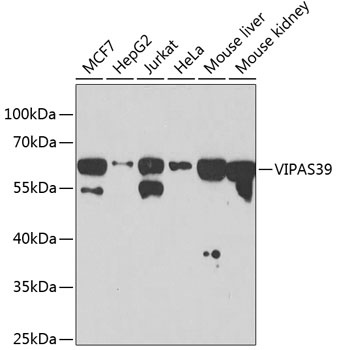 VIPAS39 Antibody