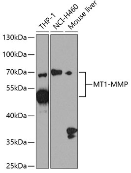 MMP14 Antibody