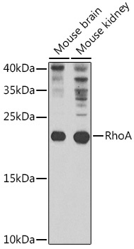 RHOA Antibody
