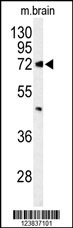 ABCD2 Antibody