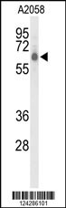 CLPTM1L Antibody