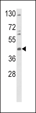 TAT Antibody