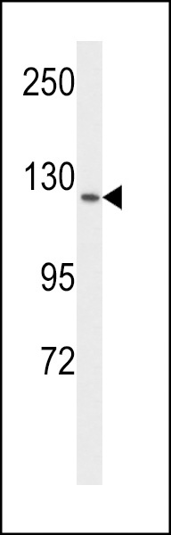 FLT1 Antibody