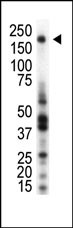 MST1R Antibody