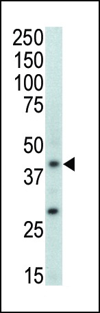 MAPK11 Antibody