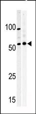 PKMYT1 Antibody