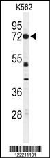 CNGA2 Antibody