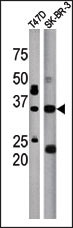 ICMT Antibody