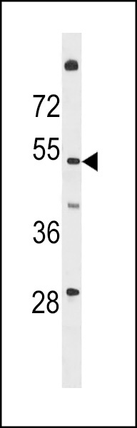 TMEM161A Antibody