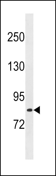 LRCH1 Antibody