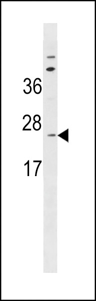 SEC11A Antibody
