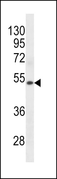 KRT72 Antibody