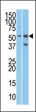 URI1 Antibody