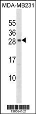 CHMP5 Antibody